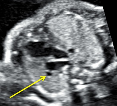 heart1-2-7-1.jpg