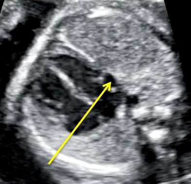 heart1-2-8-1.jpg