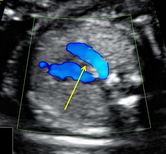 heart1-5-7.jpg