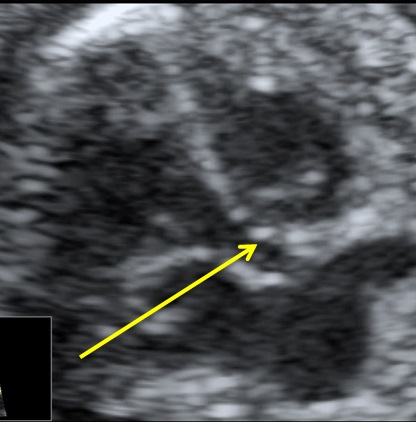 heart1-6-9.jpg
